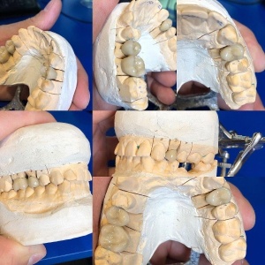 Фото от владельца Smile Dent, зуботехническая лаборатория