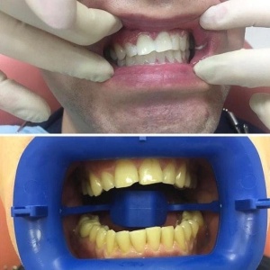Фото от владельца Smile Like, стоматологическая клиника