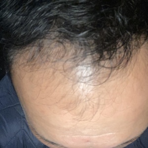 Фото от владельца АМД Лаборатории, медицинский центр по лечению волос