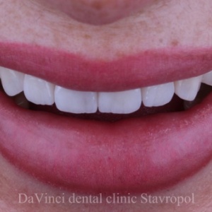 Фото от владельца Da Vinci, стоматологическая клиника