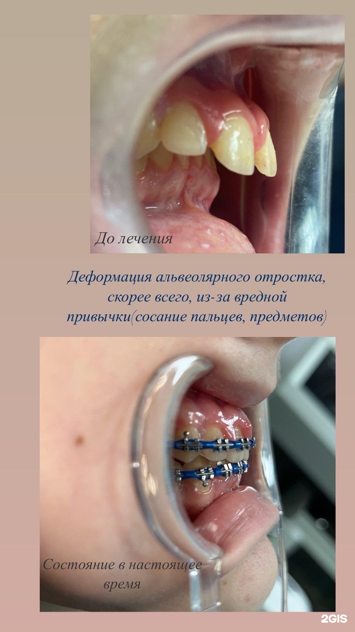 Стоматология Частная практика в Новосибирске 🦷 телефон регистратуры,  рейтинг, отзывы, цены | telephone-stomatologii.ru